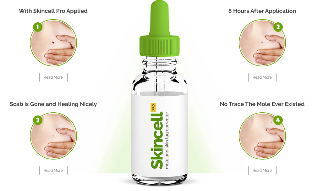 Skincell Pro Remove Moles From Face