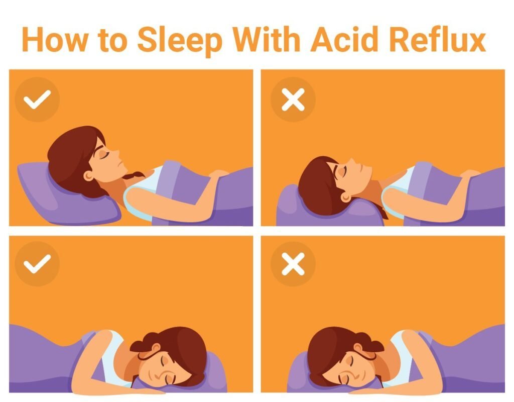 What Helps Severe Acid Reflux At Night