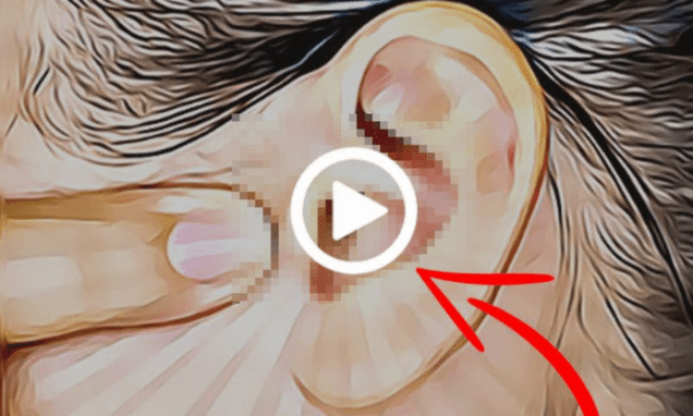 How to Stop Tinnitus