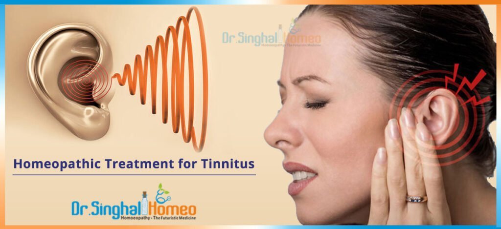 Homeopathic Remedies For Tinnitus Relief