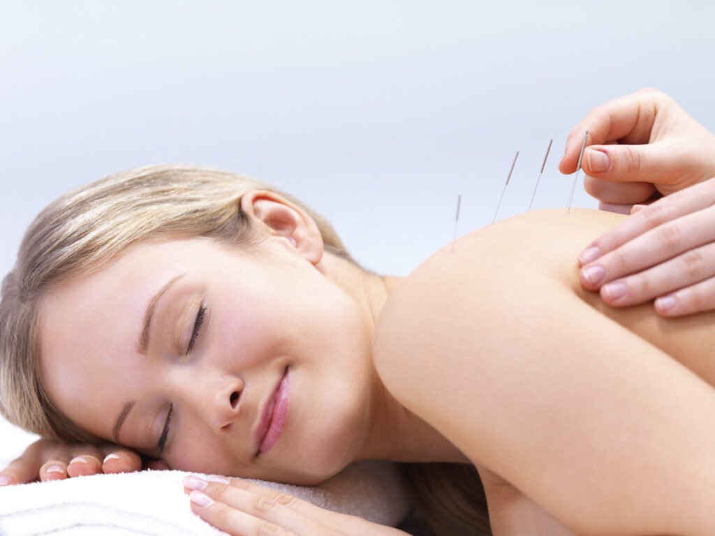 Excellent Tips To Help You With Acupuncture